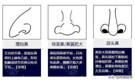 鼻子面相 男|鼻相分析10款｜鼻樑有節及橫紋、豬膽鼻、鼻頭下垂代 